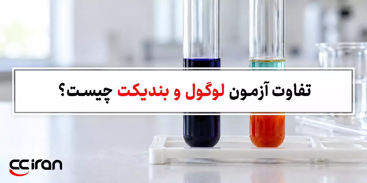 تفاوت آزمون لوگول و بندیکت چیست؟